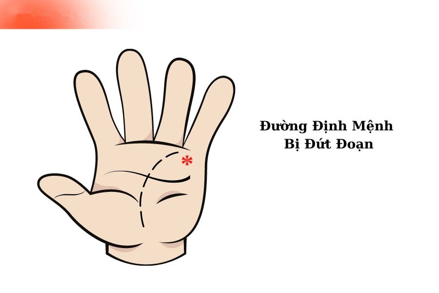 Đường định mệnh bị đứt đoạn