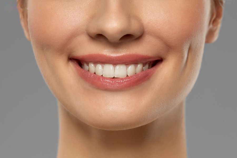 Má lúm đồng tiền là gì?