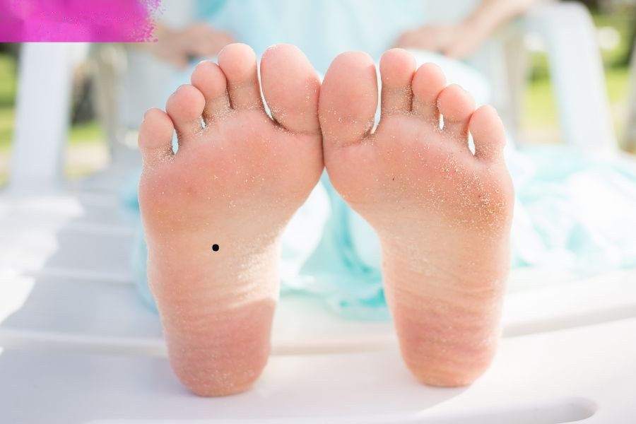Nốt ruồi lòng bàn chân đàn ông