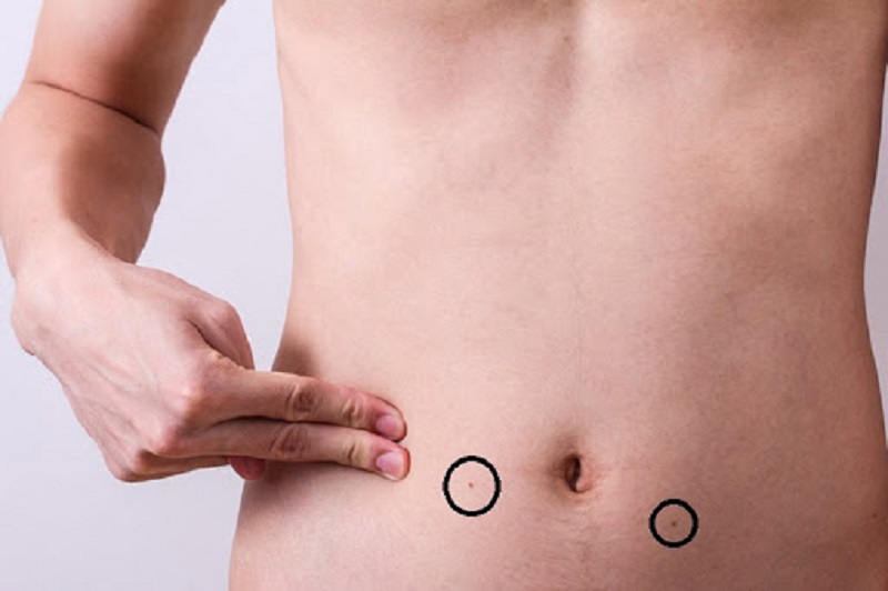 Xem tướng nốt ruồi ở bụng đàn ông