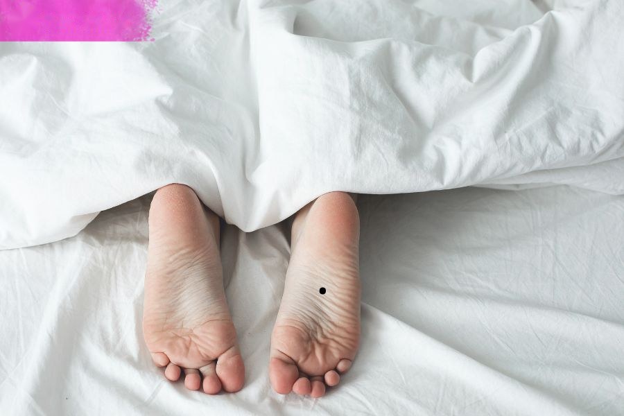 Nốt ruồi ở lòng bàn chân phụ nữ