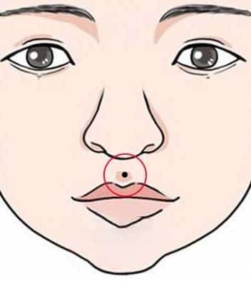 Nốt ruồi trên rãnh nhân trung đàn ông