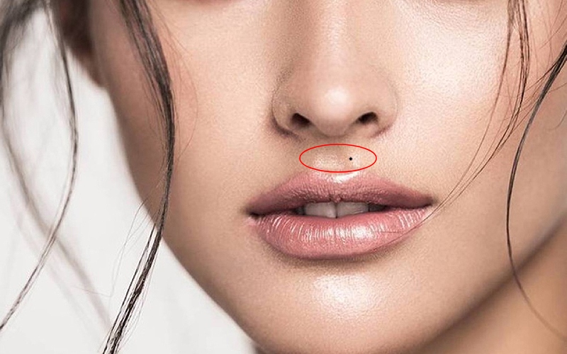 Nốt ruồi ở nhân trung có ý nghĩa gì?