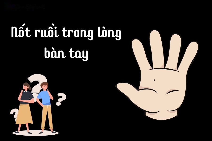 Nốt ruồi trong lòng bàn tay nam nữ bật mí điều gì?